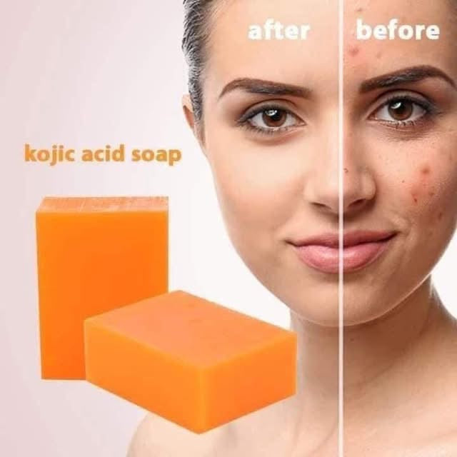 Kojie san soap