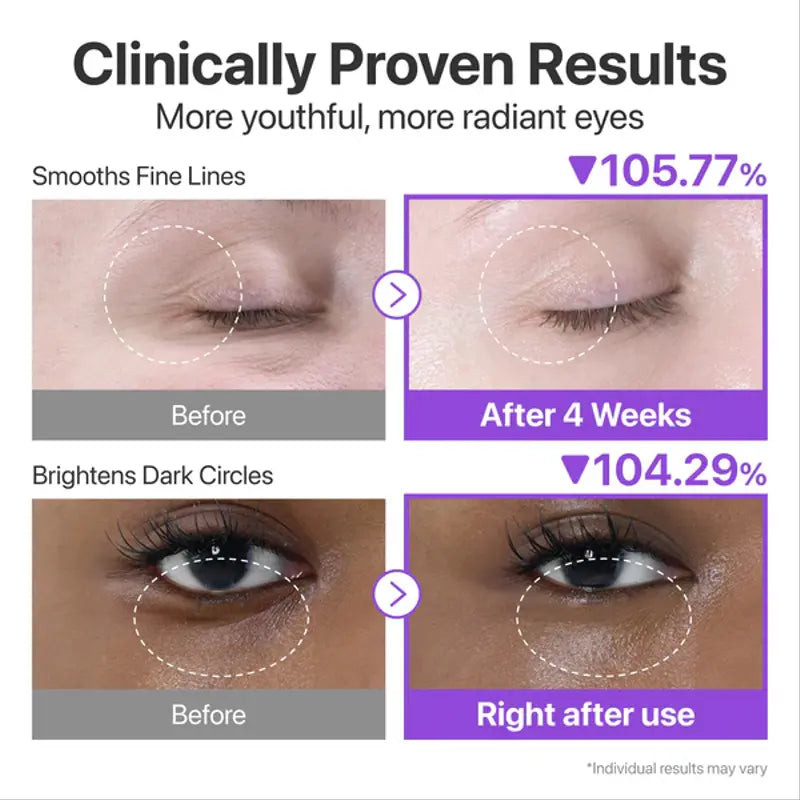 No.9 NAD+ Retinol Volumetox Eye Cream