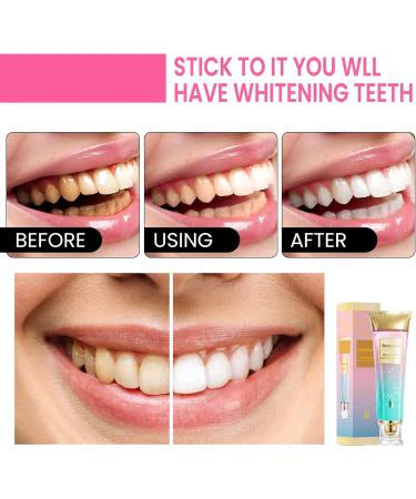 Bodyaccel Toothpaste (Niacinamide Whitening)