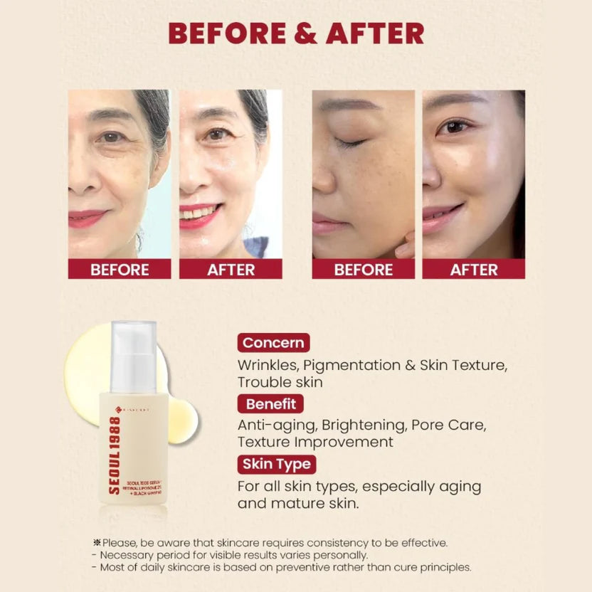 Seoul 1988 Serum : Retinal Liposome 2% + Black Ginseng